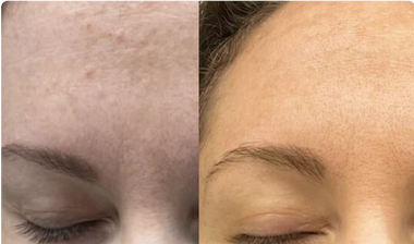 Magic Revive & Glow 6-in-1 Wrinkle-Smoothing Day Cream